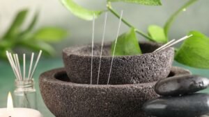 Why Integrating a CRM with Social Media Ads Lowers CPA for Medical Spas